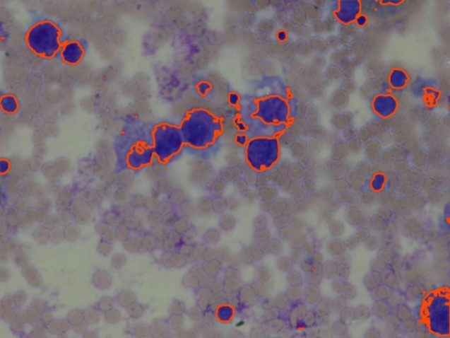 Stained microscope sample in which the system has outlined individual mast cells in orange